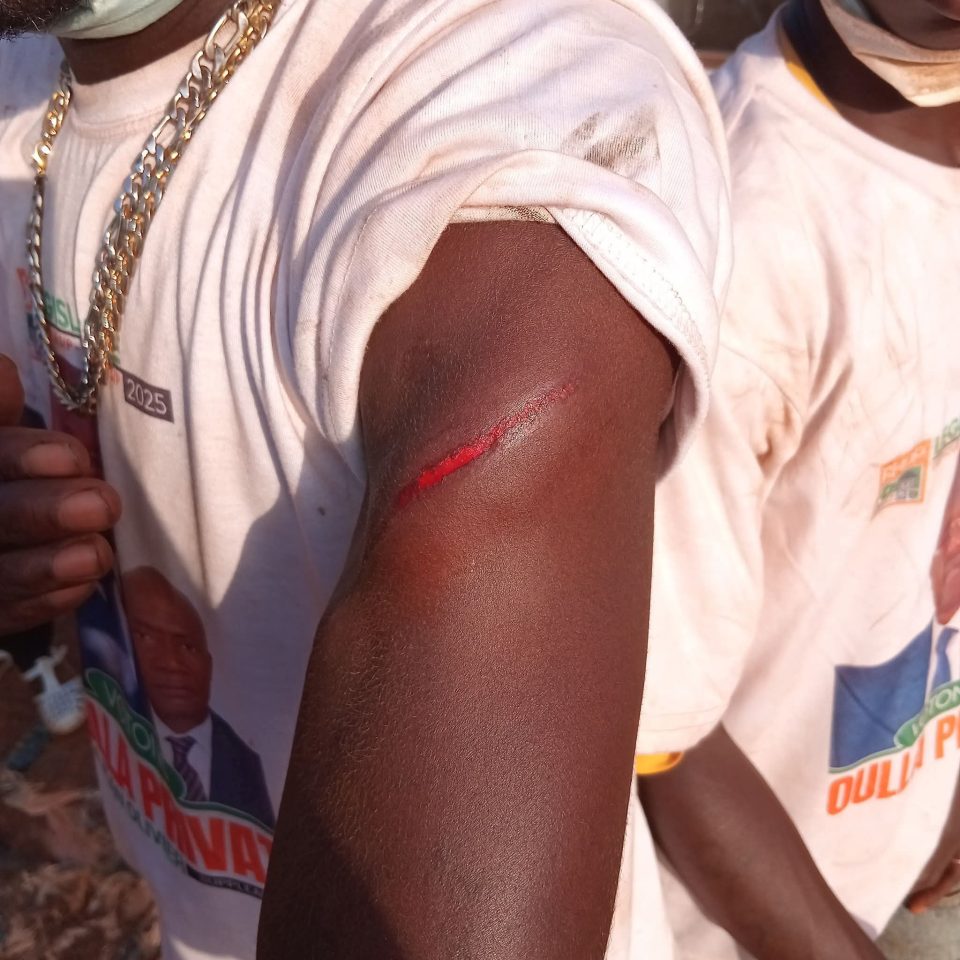 Côte d’Ivoire-AIP/ Législatives 2025: des affrontements entre partisans de candidats signalés à Guéhiébly