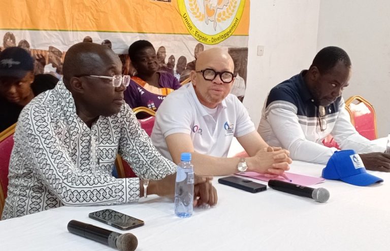 Côte d’Ivoire-AIP/ Les personnes atteintes d’albinisme plus exposées au cancer de la peau, selon un spécialiste