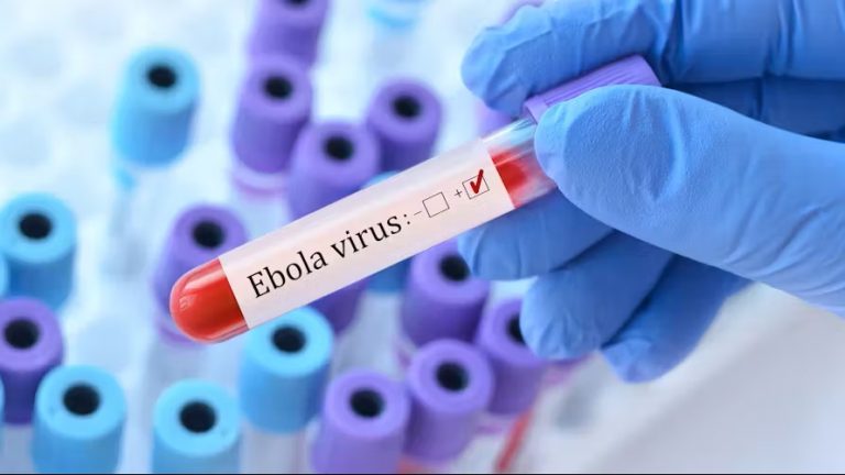 Côte d’Ivoire-AIP/Inter/ Un premier cas d’Ebola détecté en France chez un médecin de retour de RDC
