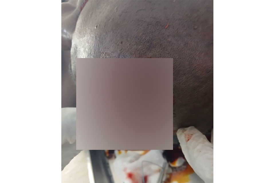 Côte d'Ivoire-AIP/ Un conflit foncier entre Kouto et Samorossoba fait une vingtaine de blessés