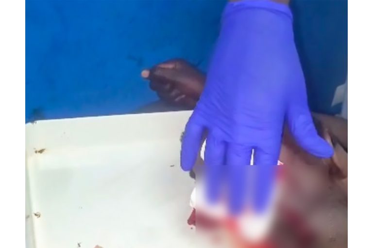 Côte d’Ivoire-AIP/ Un adolescent grièvement blessé par un buffle à Gohouo-Zagna