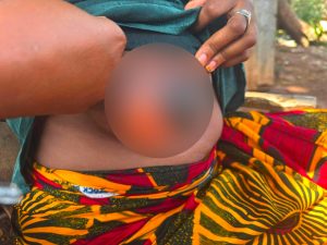Côte d’Ivoire-AIP/ Une campagne de sensibilisation au cancer du sein et du col de l’utérus organisée au marché de Touba